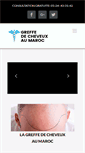Mobile Screenshot of greffe-cheveux-maroc.com
